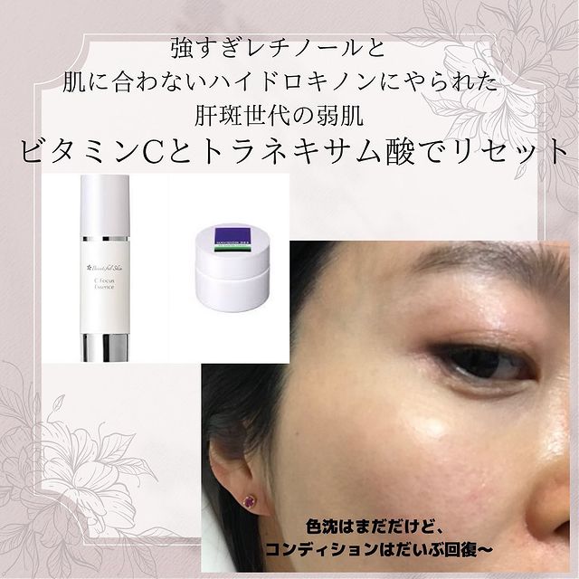 人気商品は ビューティフルスキン Cフォーカスエッセンス ad-naturam.fr